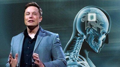 Perusahaan Elon Musk Ditolak AS Uji Tanam Chip di Otak